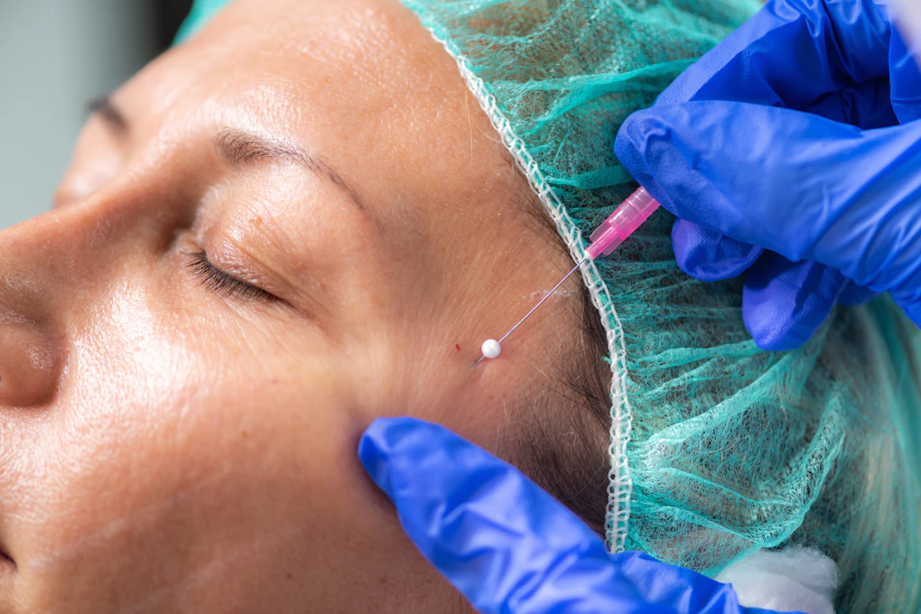 Facial markings made before a procedure